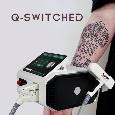Retiro del tatuaje del laser del Nd Yag del mejor